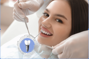 implantation dentistry